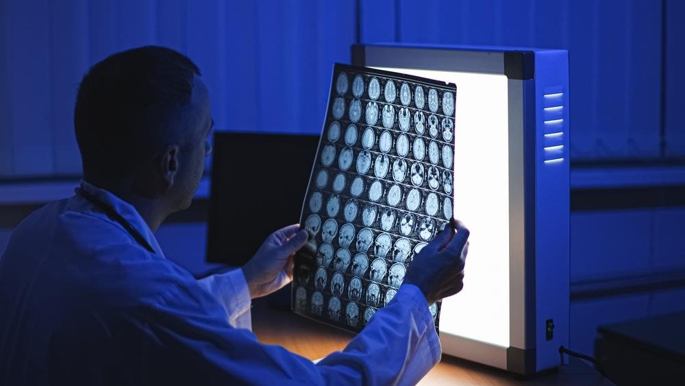 Pituitary Tumor Treatment Options