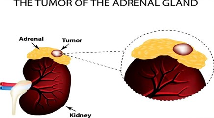 Dr. Sandeep Donagaon, Thyroid Specialist in Hubballi