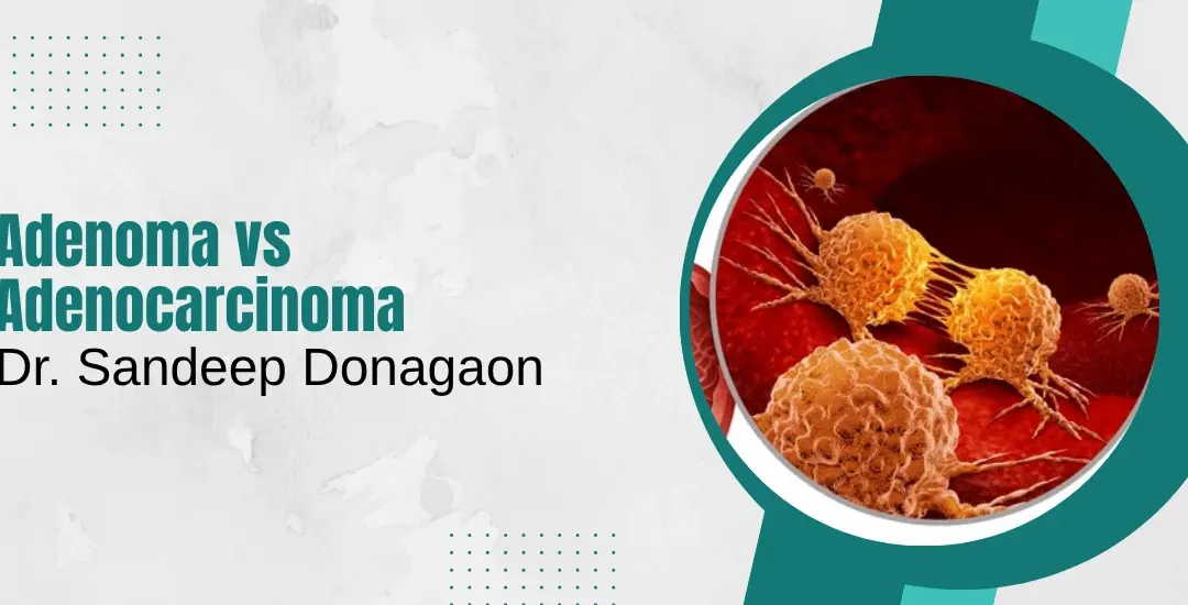 Adenoma vs Adenocarcinoma: Key Differences, Diagnosis, and What You Should Do Next