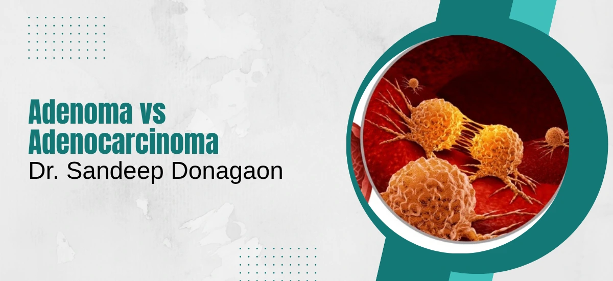 Adenoma vs Adenocarcinoma: Key Differences, Diagnosis, and What You Should Do Next