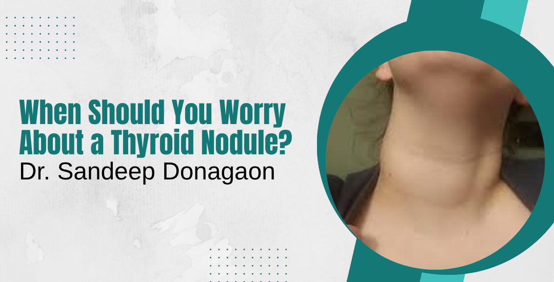 When Should You Worry About a Thyroid Nodule?