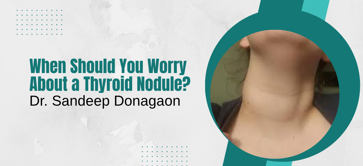 When Should You Worry About a Thyroid Nodule?