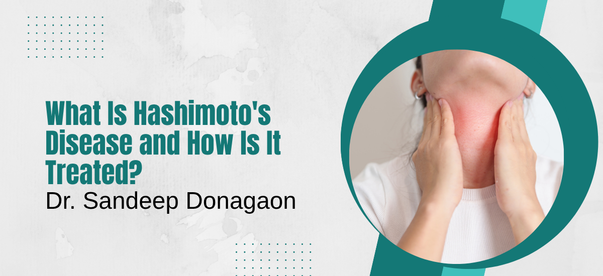 What Is Hashimoto’s Disease and How Is It Treated?